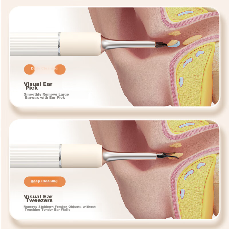 SUNUO Smart Visual Ear Spoon with Tweezers Gift Box Children's Ear Spoon Glowing...