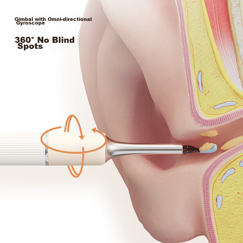 SUNUO Smart Visual Ear Spoon with Tweezers Gift Box Children's Ear Spoon Glowing...