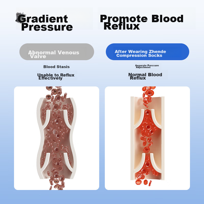 Zhende Medical Varicose Vein Compression Stockings, Pressure Level 2 Short Strai...
