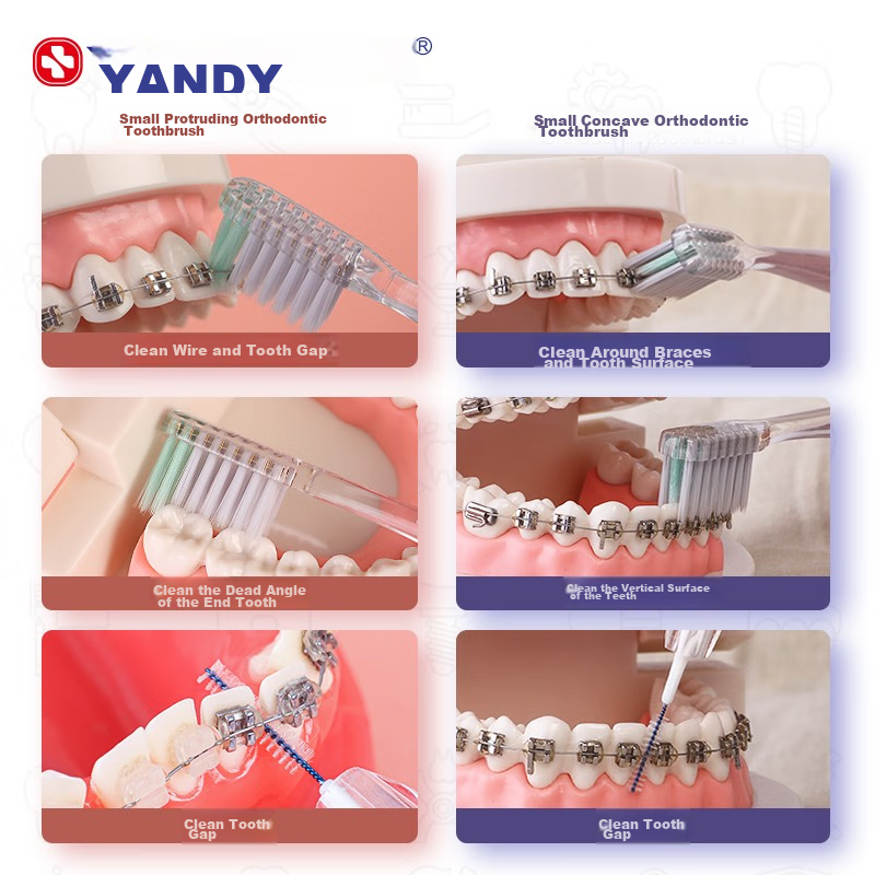 YANDY Orthodontic Toothbrush, Concave U-Shaped, 3-Pack, for Adults And Children...